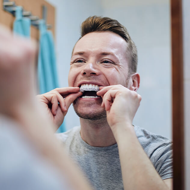 Why Angel Aligners are different Why Angel Aligners are different