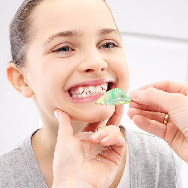 Palatal expanders - creating space for developing smiles Palatal expanders - creating space for developing smiles