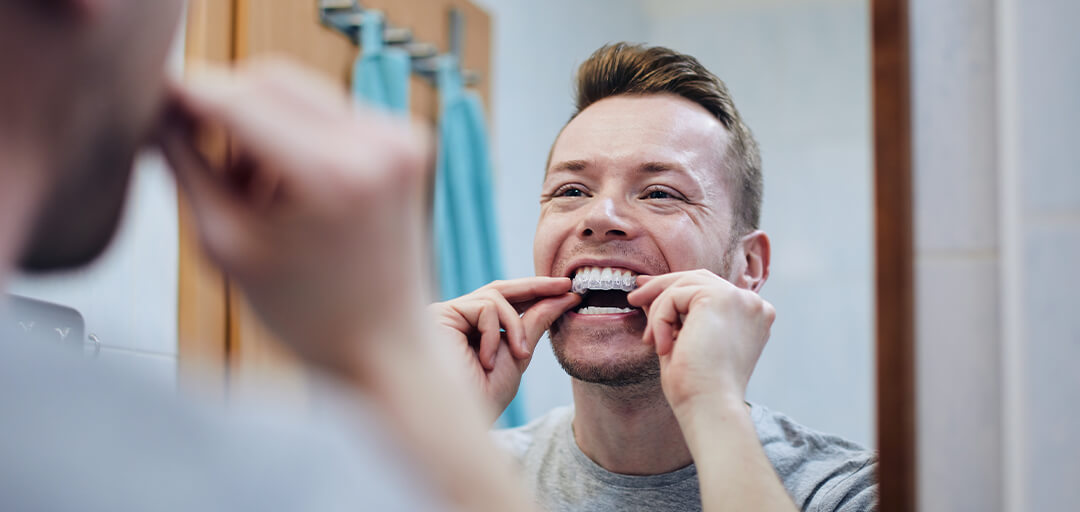Retention Matters: Why Wearing Your Retainer Protects Your New Smile