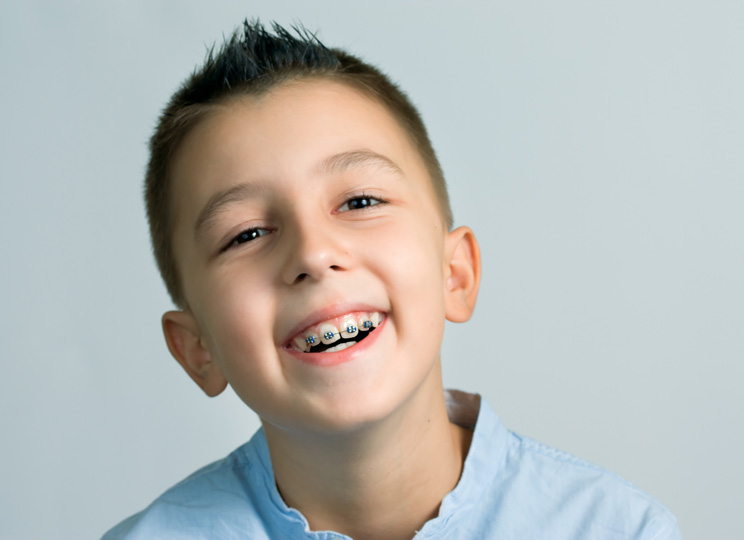 Braces for kids - early treatment for a lifetime of smiles Braces for kids - early treatment for a lifetime of smiles
