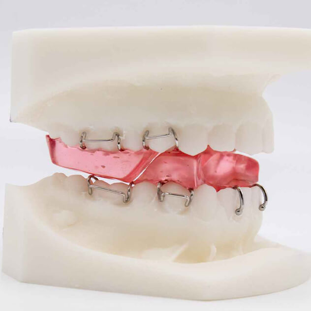 Functional appliances - guiding jaw growth Functional appliances - guiding jaw growth