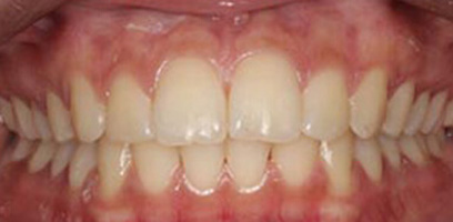 Before & Afters