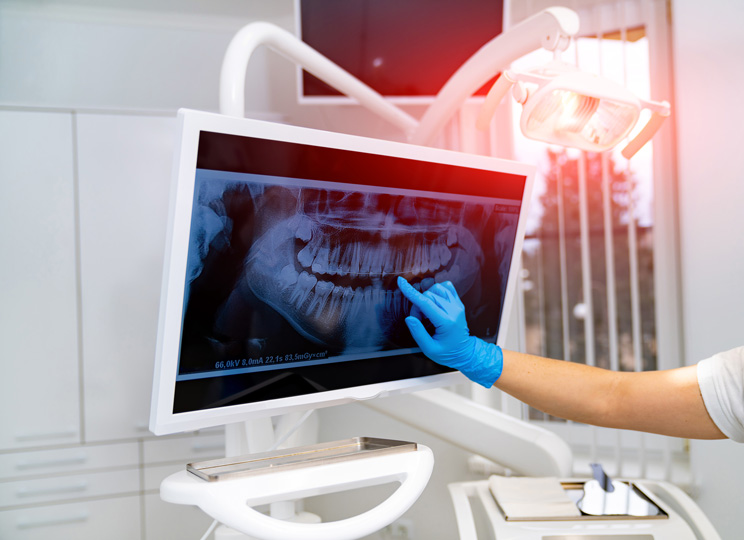 Jaw surgery – expert solutions for complex bite and jaw issues Jaw surgery – expert solutions for complex bite and jaw issues