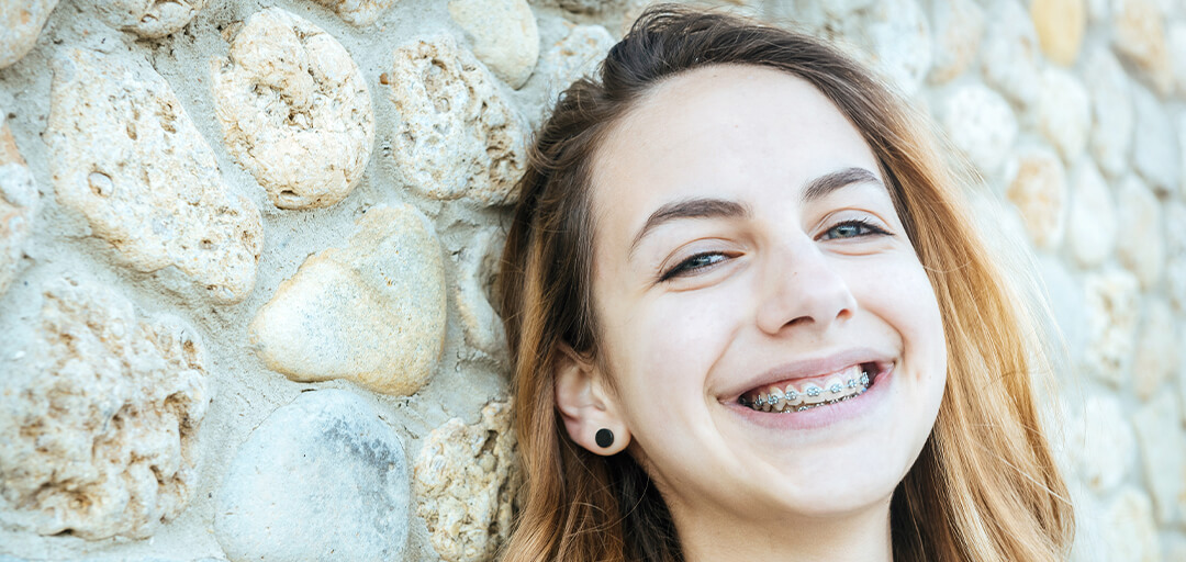 Are Braces Worth It? An Honest Look at Cost, Time and Results