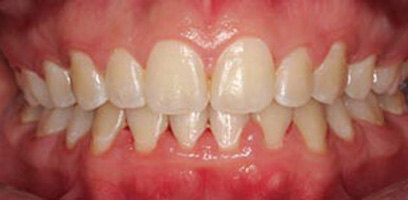 Before & Afters