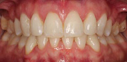 Before & Afters