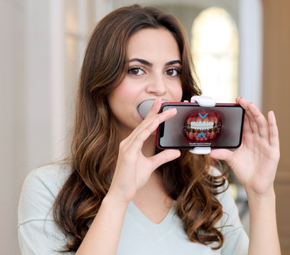 Smarter orthodontic care with Dental Monitoring