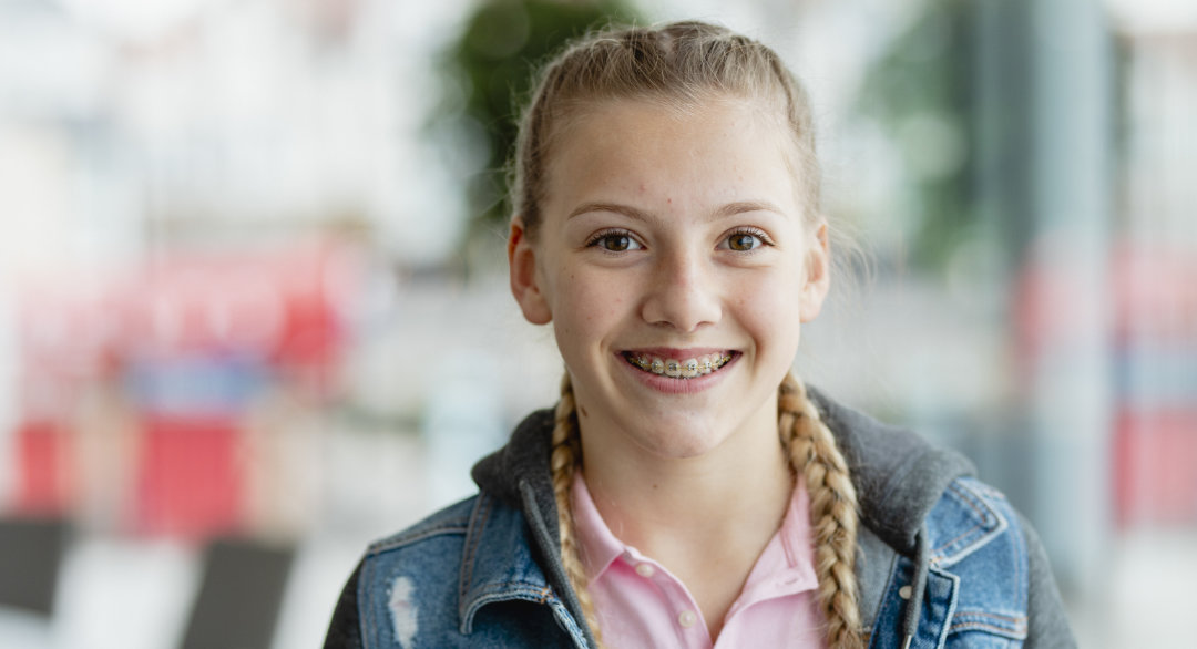 Kids and Teen Braces: The Right Time to Start and How to Plan It