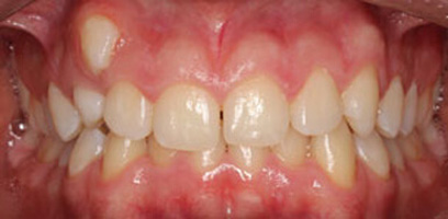 Before & Afters