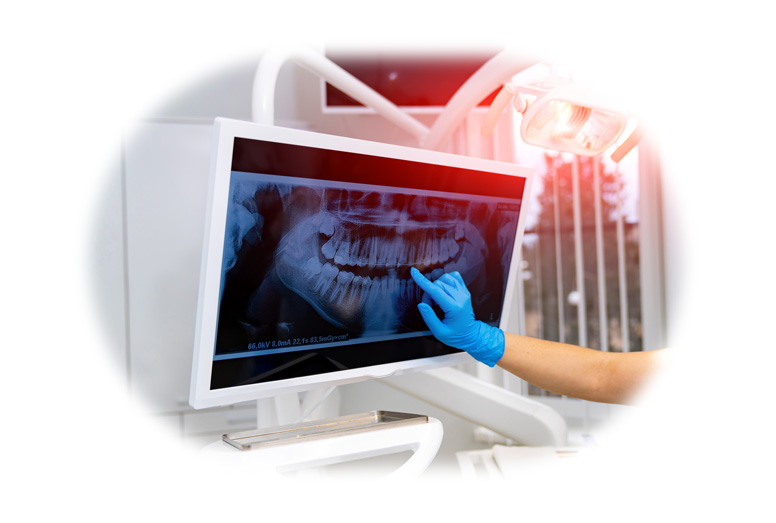Jaw surgery
