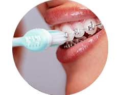 Orthodontic care